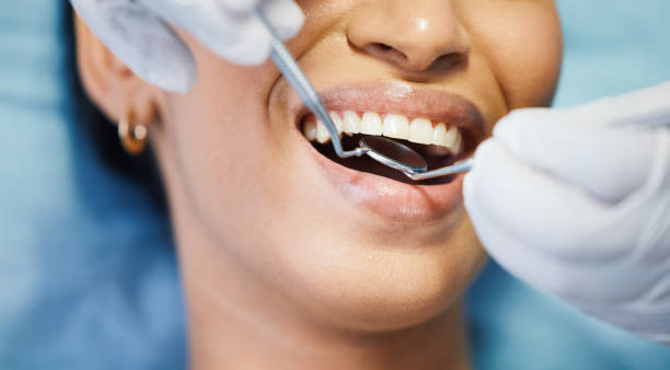 Best Broken or Cracked Tooth Emergency Dentist in Berkshire Lakes, FL